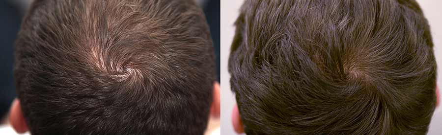 Czy HairPerfecta można kupić w aptece?